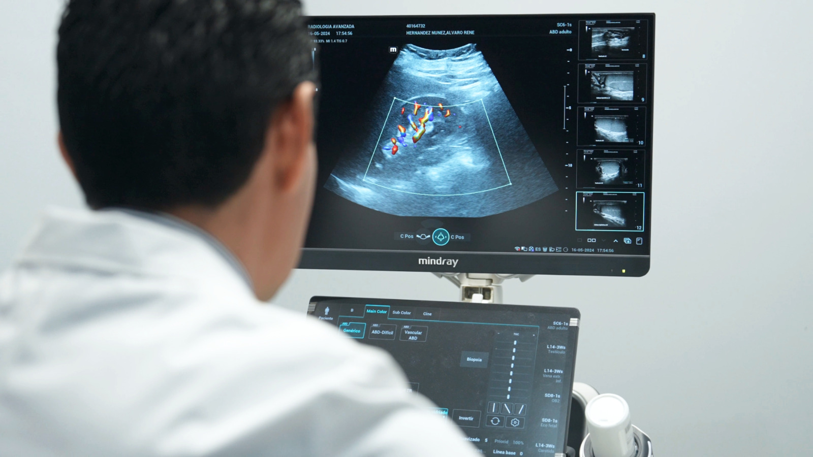 Ultrasonido en OPUS Salud